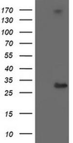 RFXANK Antibody in Western Blot (WB)