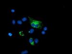 GADD34 Antibody in Immunocytochemistry (ICC/IF)