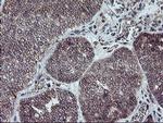 GADD34 Antibody in Immunohistochemistry (Paraffin) (IHC (P))