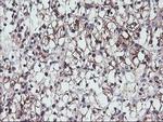 GADD34 Antibody in Immunohistochemistry (Paraffin) (IHC (P))