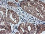 GADD34 Antibody in Immunohistochemistry (Paraffin) (IHC (P))