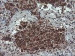 GADD34 Antibody in Immunohistochemistry (Paraffin) (IHC (P))