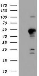 GADD34 Antibody in Western Blot (WB)