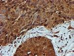 PSMB9 Antibody in Immunohistochemistry (Paraffin) (IHC (P))