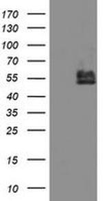 BCAT1 Antibody in Western Blot (WB)