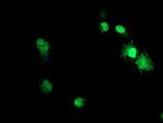 ACD Antibody in Immunocytochemistry (ICC/IF)