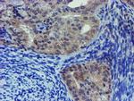 LIM1 Antibody in Immunohistochemistry (Paraffin) (IHC (P))