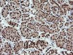 FATE1 Antibody in Immunohistochemistry (Paraffin) (IHC (P))