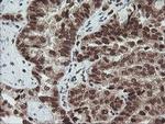 FATE1 Antibody in Immunohistochemistry (Paraffin) (IHC (P))