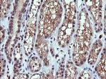 PIK3CG Antibody in Immunohistochemistry (Paraffin) (IHC (P))