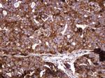 ATP6V1B2 Antibody in Immunohistochemistry (Paraffin) (IHC (P))