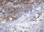 MRPL11 Antibody in Immunohistochemistry (Paraffin) (IHC (P))