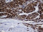 MRPL11 Antibody in Immunohistochemistry (Paraffin) (IHC (P))