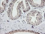 CATIP Antibody in Immunohistochemistry (Paraffin) (IHC (P))