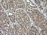 CATIP Antibody in Immunohistochemistry (Paraffin) (IHC (P))