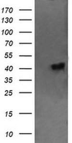 CATIP Antibody in Western Blot (WB)