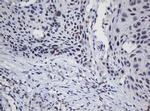 TRMT2A Antibody in Immunohistochemistry (Paraffin) (IHC (P))