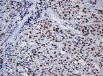 TRMT2A Antibody in Immunohistochemistry (Paraffin) (IHC (P))