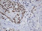 TRMT2A Antibody in Immunohistochemistry (Paraffin) (IHC (P))