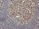 TRMT2A Antibody in Immunohistochemistry (Paraffin) (IHC (P))