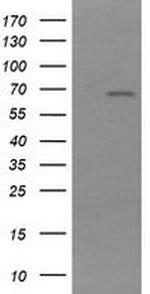 NR1 Antibody in Western Blot (WB)