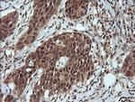 LZIC Antibody in Immunohistochemistry (Paraffin) (IHC (P))