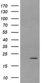 LZIC Antibody in Western Blot (WB)