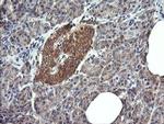 DNM1L Antibody in Immunohistochemistry (Paraffin) (IHC (P))