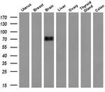 DNM1L Antibody in Western Blot (WB)