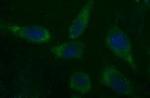 CSH1 Antibody in Immunocytochemistry (ICC/IF)