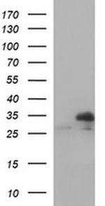 TMX Antibody in Western Blot (WB)