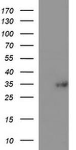 TMX Antibody in Western Blot (WB)