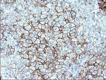 SR-BI Antibody in Immunohistochemistry (Paraffin) (IHC (P))