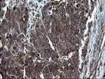 Alix Antibody in Immunohistochemistry (Paraffin) (IHC (P))