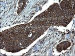 Alix Antibody in Immunohistochemistry (Paraffin) (IHC (P))