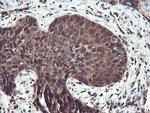 TRIP Antibody in Immunohistochemistry (Paraffin) (IHC (P))