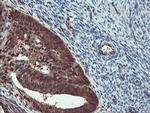 TRIP Antibody in Immunohistochemistry (Paraffin) (IHC (P))