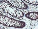 TRIP Antibody in Immunohistochemistry (Paraffin) (IHC (P))