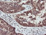 TRIP Antibody in Immunohistochemistry (Paraffin) (IHC (P))