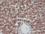 TRIP Antibody in Immunohistochemistry (Paraffin) (IHC (P))