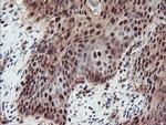 TRIP Antibody in Immunohistochemistry (Paraffin) (IHC (P))