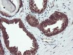 TRIP Antibody in Immunohistochemistry (Paraffin) (IHC (P))