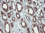 TRIP Antibody in Immunohistochemistry (Paraffin) (IHC (P))