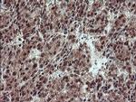 TRIP Antibody in Immunohistochemistry (Paraffin) (IHC (P))