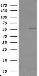 TRIP Antibody in Western Blot (WB)