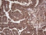 Dicer Antibody in Immunohistochemistry (Paraffin) (IHC (P))