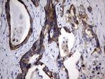 PIK3CD Antibody in Immunohistochemistry (Paraffin) (IHC (P))