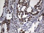 PIK3CD Antibody in Immunohistochemistry (Paraffin) (IHC (P))