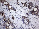 PIK3CD Antibody in Immunohistochemistry (Paraffin) (IHC (P))