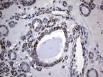 PIK3CD Antibody in Immunohistochemistry (Paraffin) (IHC (P))